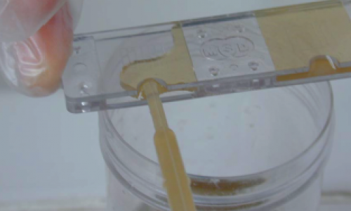 Analyses coprologiques